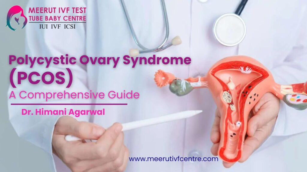 Polycystic Ovary Syndrome PCOS