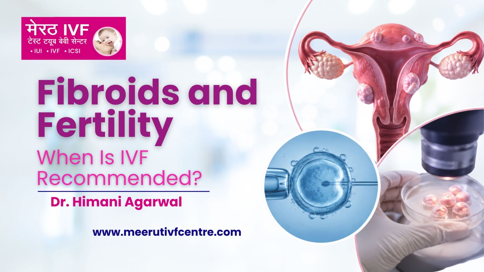 Fibroids and Fertility